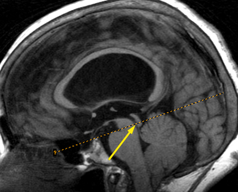 Exam Details - Peace Regional MRI clinic in Dawson Creek